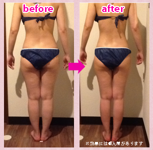 施術のbefore・after