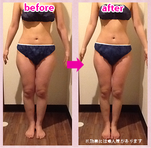 before・after写真